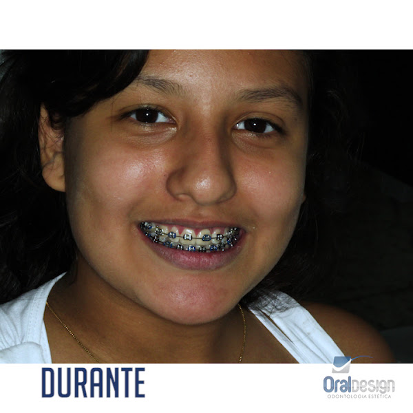 Foto 3 de Oral Design Odontologia Especializada