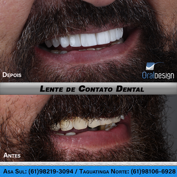 Foto 3 de Oral Design Taguatinga