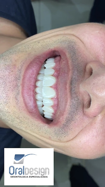 Foto 4 de Oral Design Taguatinga