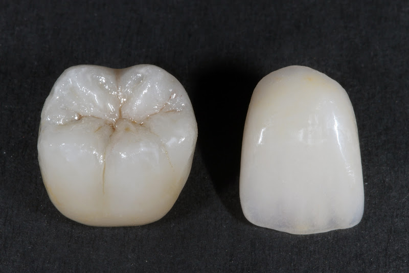 Foto 3 de Oral Designer - Clínica Odontológica