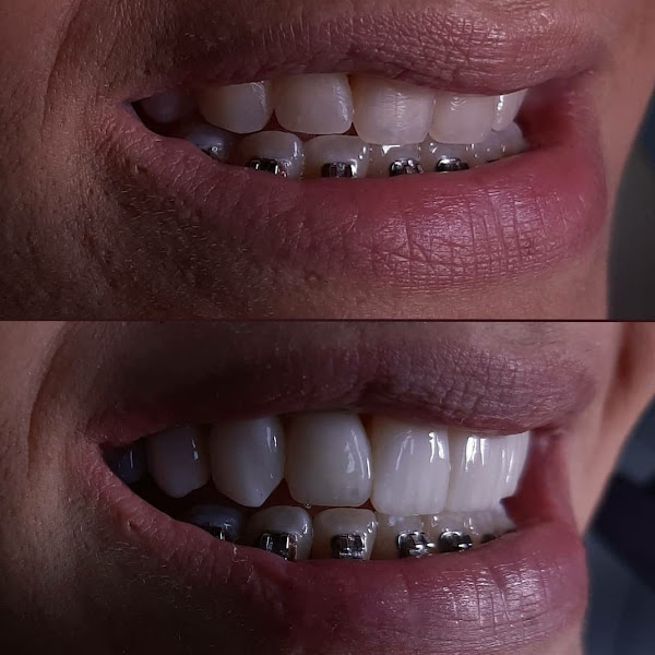 Foto 3 de Oral Designer Natal