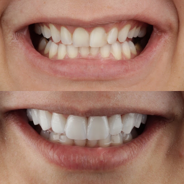 Foto 3 de ORAL ESTHETIC - DR JOÃO ANTONIO FILHO