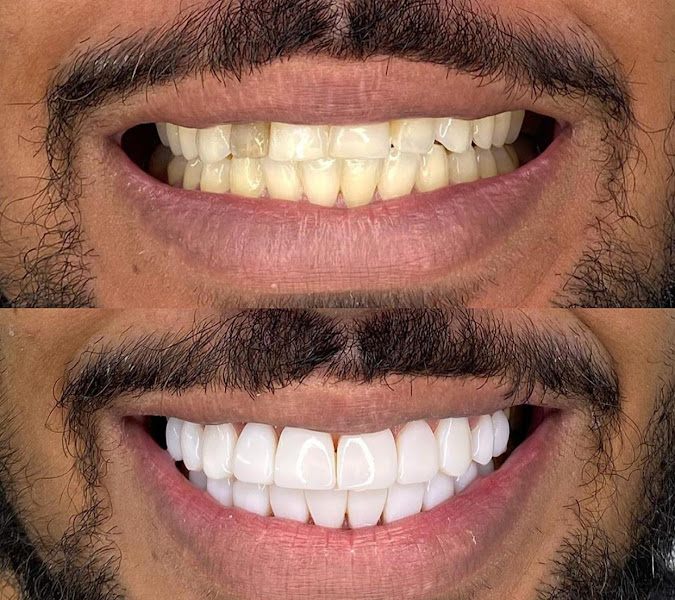 Foto 2 de Oral Esthetic Odontologia Especializada