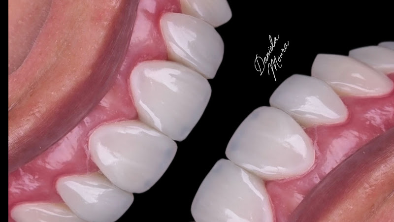 Foto 2 de Oral Esthetics