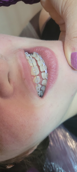 Foto 2 de Oral Face Ortodontia e Implantodontia