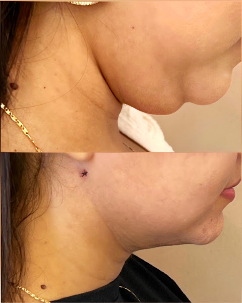 Foto 3 de Oral facialis