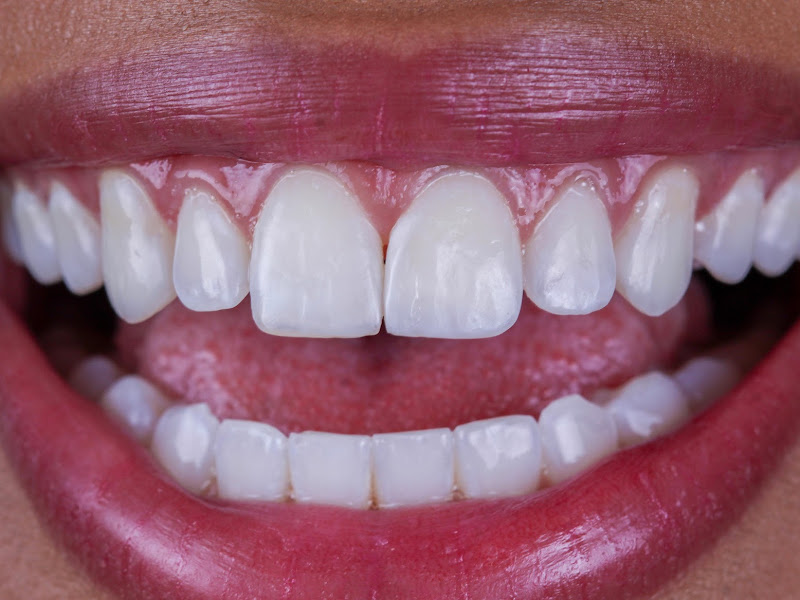 Foto 8 de Oral Health Centro Odontológico - Brooklin/Berrini