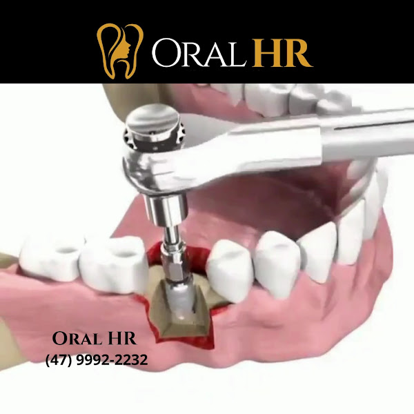 Foto 3 de Oral HR