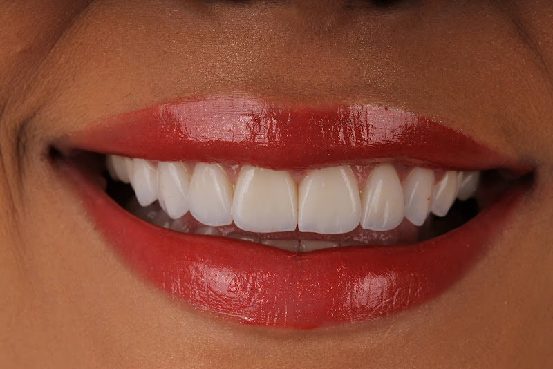 Foto 2 de Oral Implant Odontologia Avançada