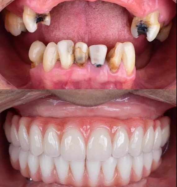 Foto 3 de Oral Implant Odontologia Avançada