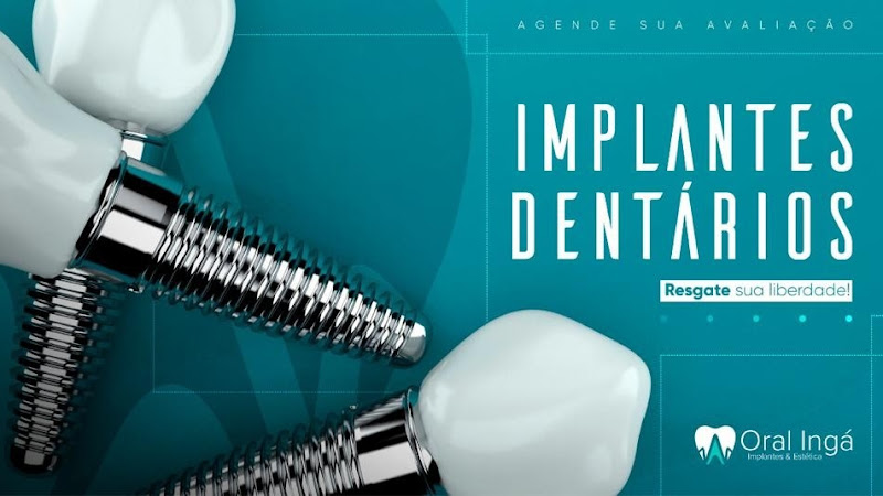 Foto 2 de Oral Ingá - Implantes Dentários