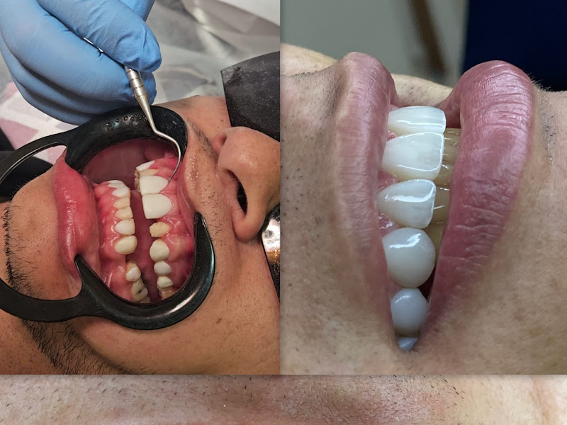 Foto 2 de Oral Laser