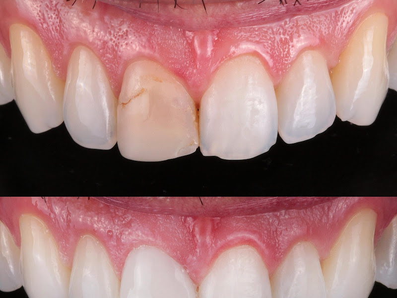 Foto 6 de Oral Premium Referência em Odontologia em Natal