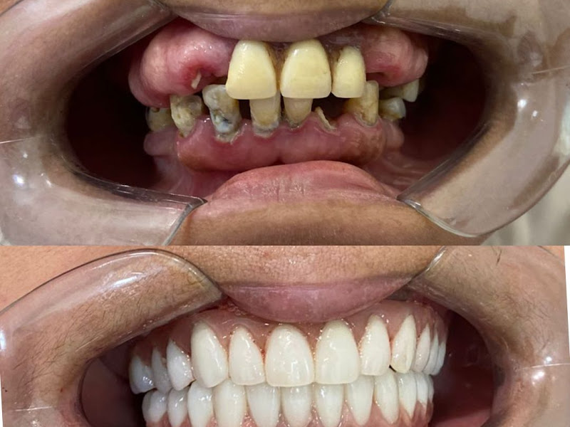 Foto 4 de Oral Prime Clínica Odontológica