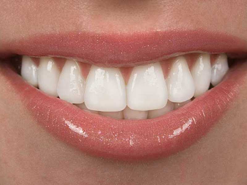 Foto 7 de Oral Salute Odontologia Dentista Osasco