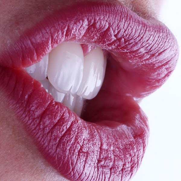 Foto 2 de Oral Select - Implantes e Lentes de contato Dental