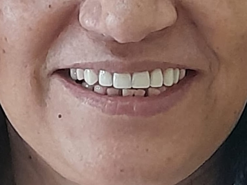 Foto 11 de Oral Sin Americana