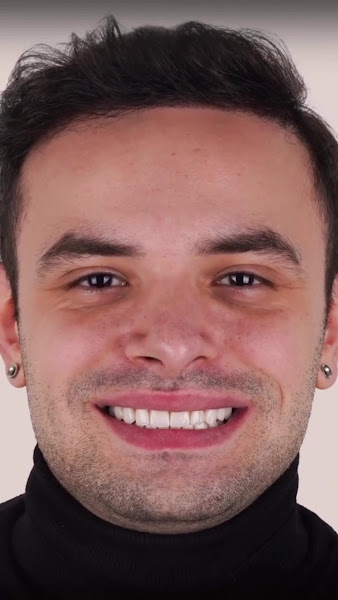 Foto 2 de Oral Sin Implantes