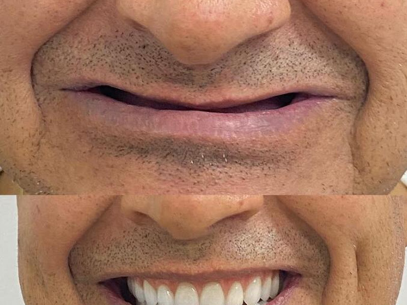 Foto de Oral Sin Implantes Curitiba - Santa Felicidade