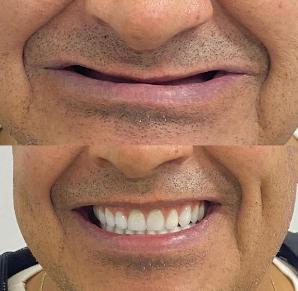Foto 2 de Oral Sin Implantes Curitiba - Santa Felicidade