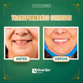 Foto 3 de Oral Sin Implantes Curitiba - Santa Felicidade