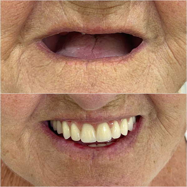 Foto 4 de Oral Sin Implantes Curitiba - Santa Felicidade