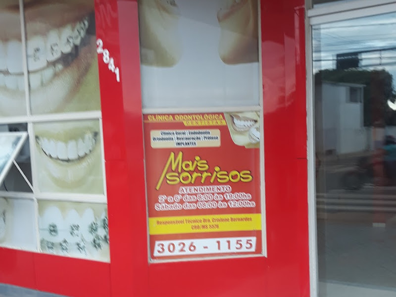 Foto 10 de ORAL SIN IMPLANTES DENTÁRIOS | DENTISTA EM CAMPO GRANDE | MEIA PRAIA