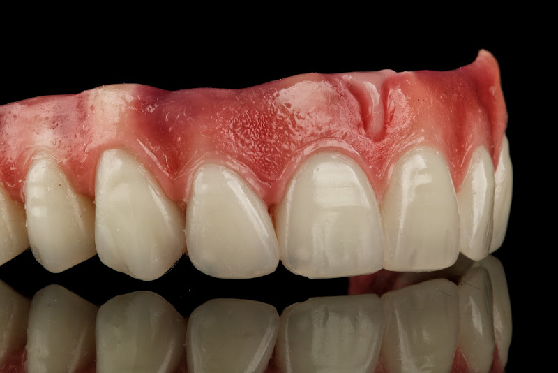 Foto 2 de Oral Sin Implantes - Pelotas