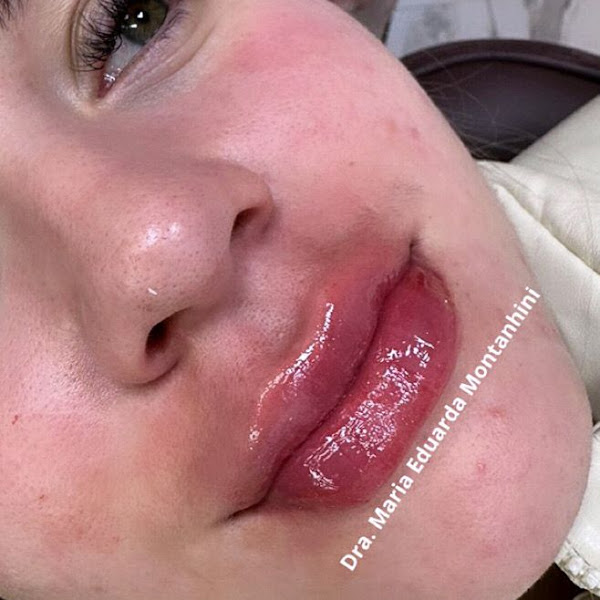 Foto 4 de Oral Tech MV - Clínica Odontológica Especializada