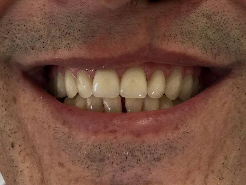 Foto 10 de Oral Tech MV - Clínica Odontológica Especializada