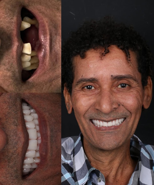 Foto 2 de Oral Unic Implantes | Especialista em Implante Dentário em Feira de Santana
