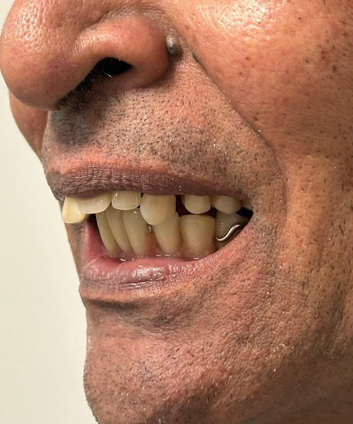 Foto 3 de Oral Unic Implantes | Especialista em Implante Dentário em Feira de Santana