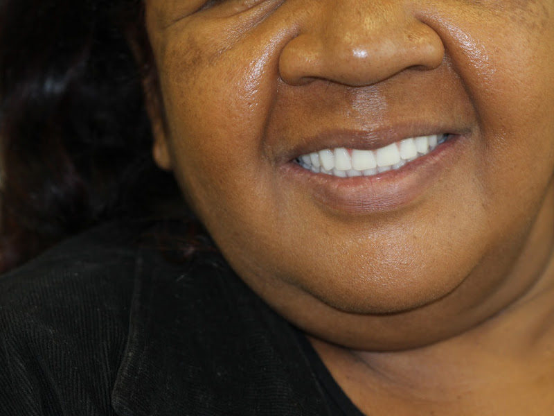 Foto 3 de Oral Unic Implantes Maringá