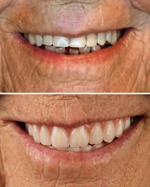 Foto 2 de Oral Unic Implantes Passo Fundo