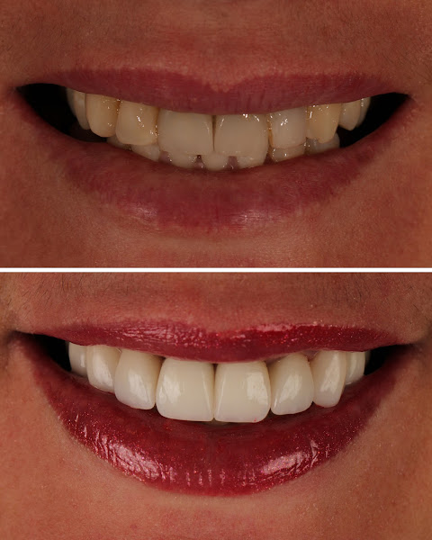 Foto 3 de Oral Unic Implantes Passo Fundo