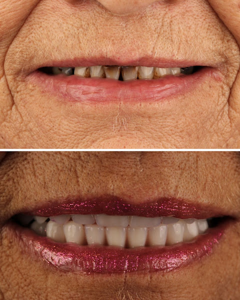 Foto 4 de Oral Unic Implantes Passo Fundo