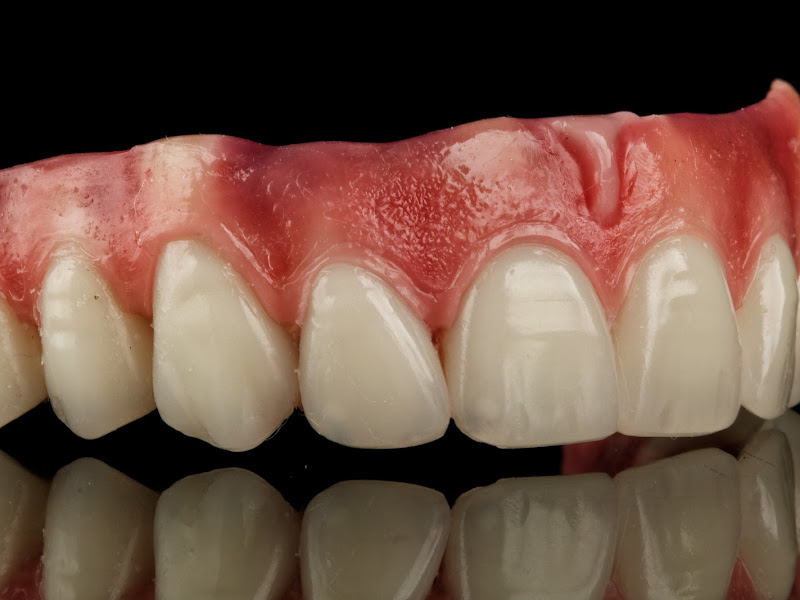 Foto 7 de Oral Unic Implantes Pelotas