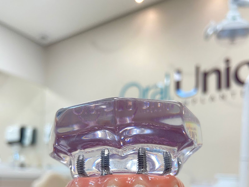 Foto 9 de Oral Unic Implantes São Gonçalo