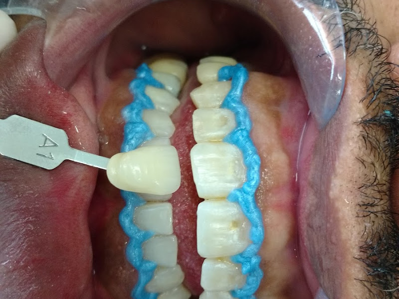 Foto 10 de Oral Unic Implantes São Gonçalo