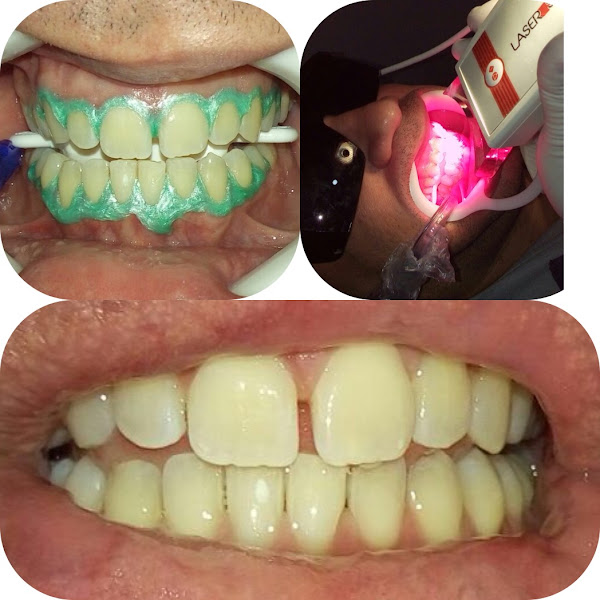 Foto 3 de ORAL VITAL clínica Odontológica