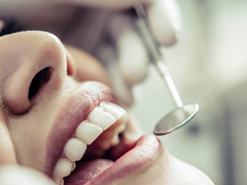 Foto 9 de Oral Vitta