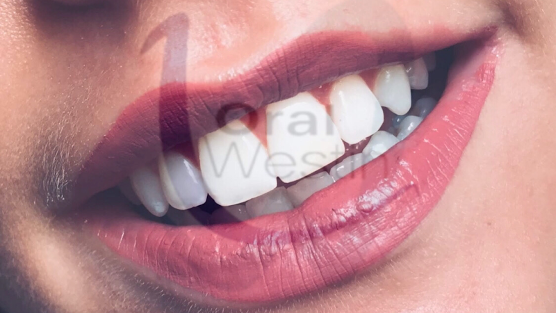 Foto 2 de Oral Westin odontologia