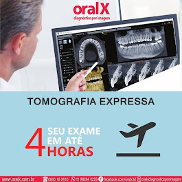 Foto 3 de Oral X Tatuapé