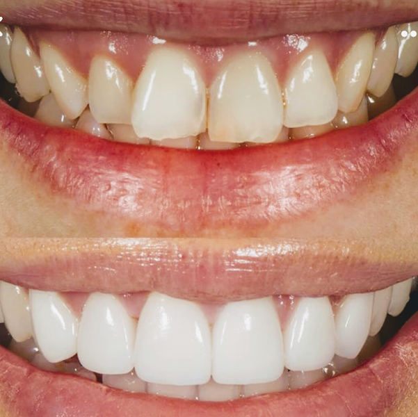 Foto 2 de Oralar Odontologia