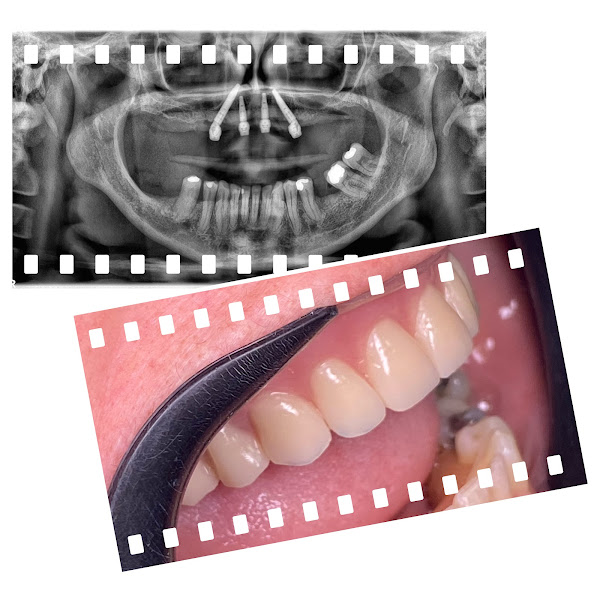 Foto 3 de OralCenter Implantes