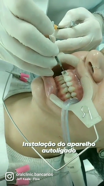 Foto 3 de Oralclinic Bancários clínica odontológica