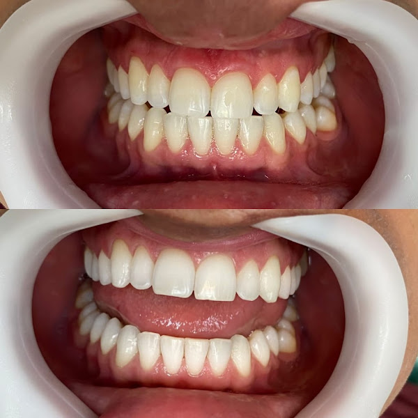 Foto 2 de OralDents (Bom Retiro - Ipatinga)