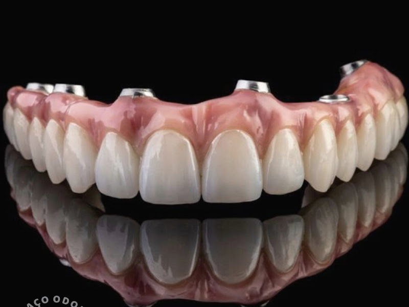 Foto 7 de OralDents Campos de Goytacazes | Dentista em Campos dos Goytacazes | Clínica odontológica | Prótese dental