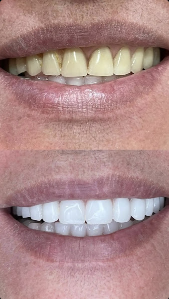 Foto 3 de OralDents (Linhares) | Dentista, Implante Dentário, Prótese Dentária, Prótese Protocolo, Clareamento, Facetas, Botox