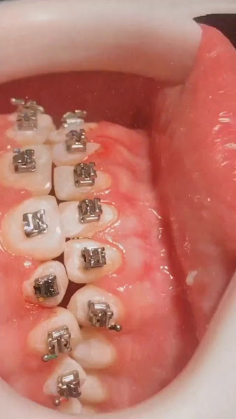 Foto 3 de Orales Odontologia